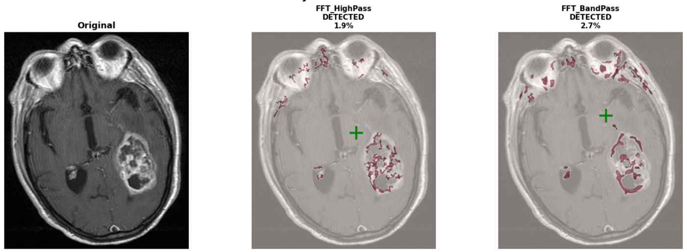 A second MRI slice showing FFT high-pass and band-pass tumor detection overlays with a predicted-centre green cross